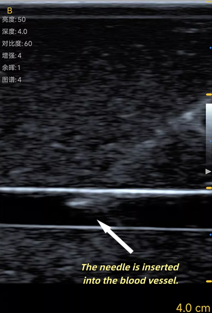 Ultrason Vasküler Punktür Eğit - Medical Gel Ultrasound incelemesi ve fiyatı